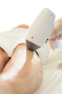Laser hair removal handpiece on the leg