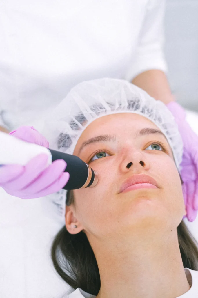Laser handpiece treatment on the face