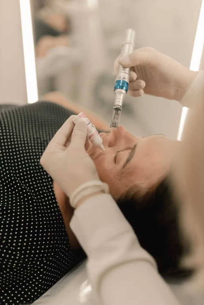 Microneedling pen treatment on the face