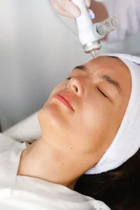 Radiofrequency handpiece on the face
