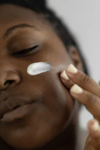Cream applied to the cheek