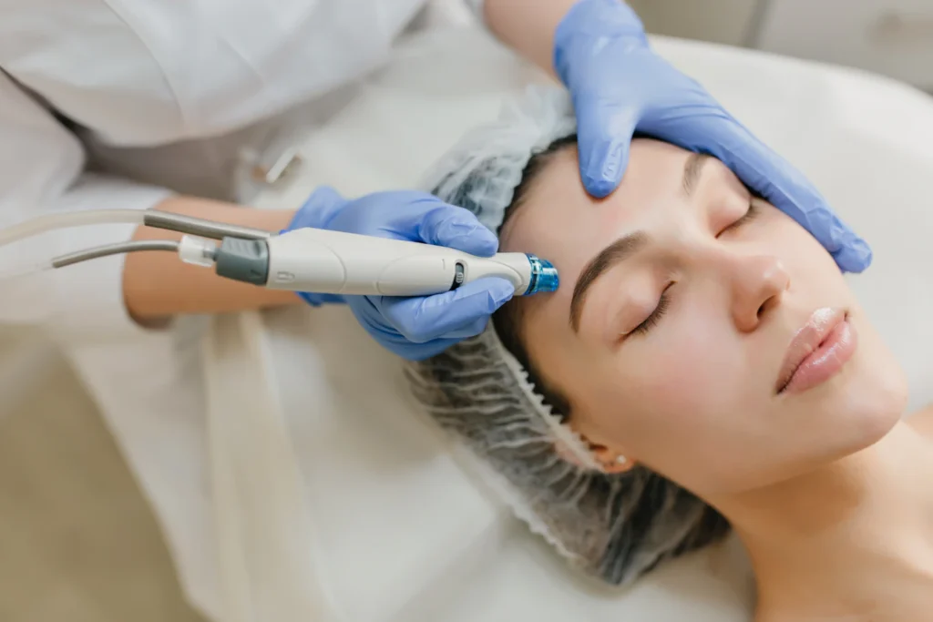 HIFU-style ultrasound handpiece used on a relaxed face